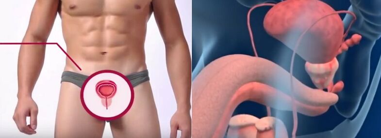 Prostatite negli uomini, riconoscibile da alcuni segni