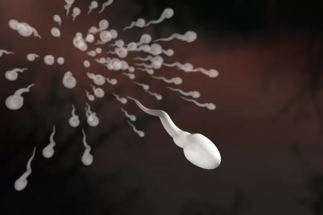 spermatozoi e loro alterazioni nella prostatite